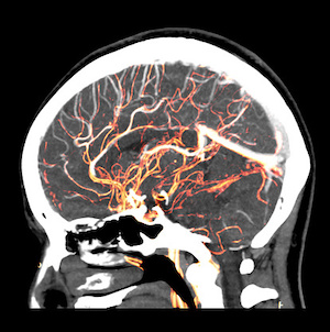 brain health image